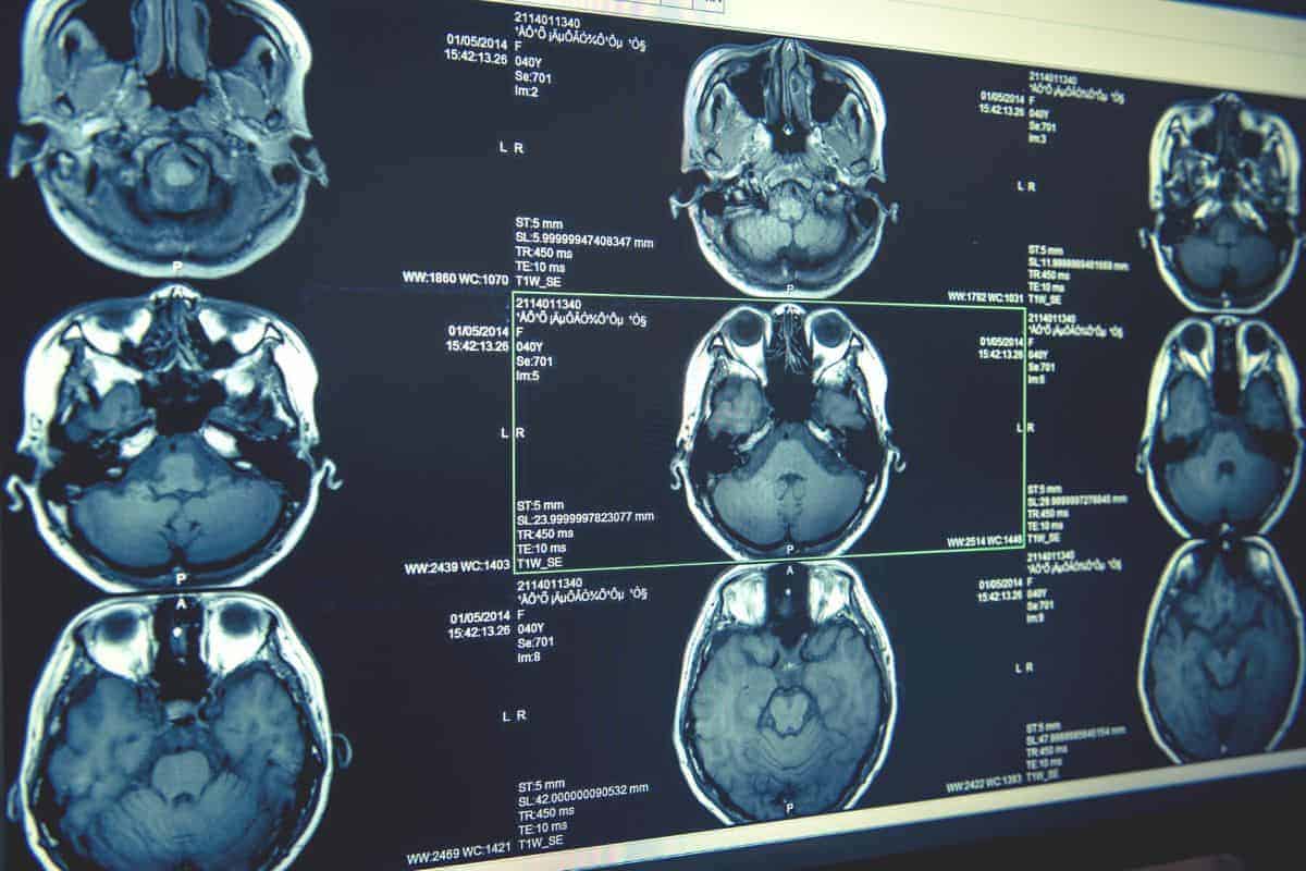 CT scan cost in Malaysia